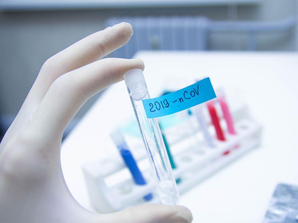 coronavirus diagnostic test